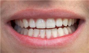 2026年全球口腔设备行业技术创新与投资机会洞察