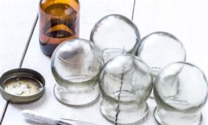 2026年中国真空玻璃行业发展现状与投资机会分析